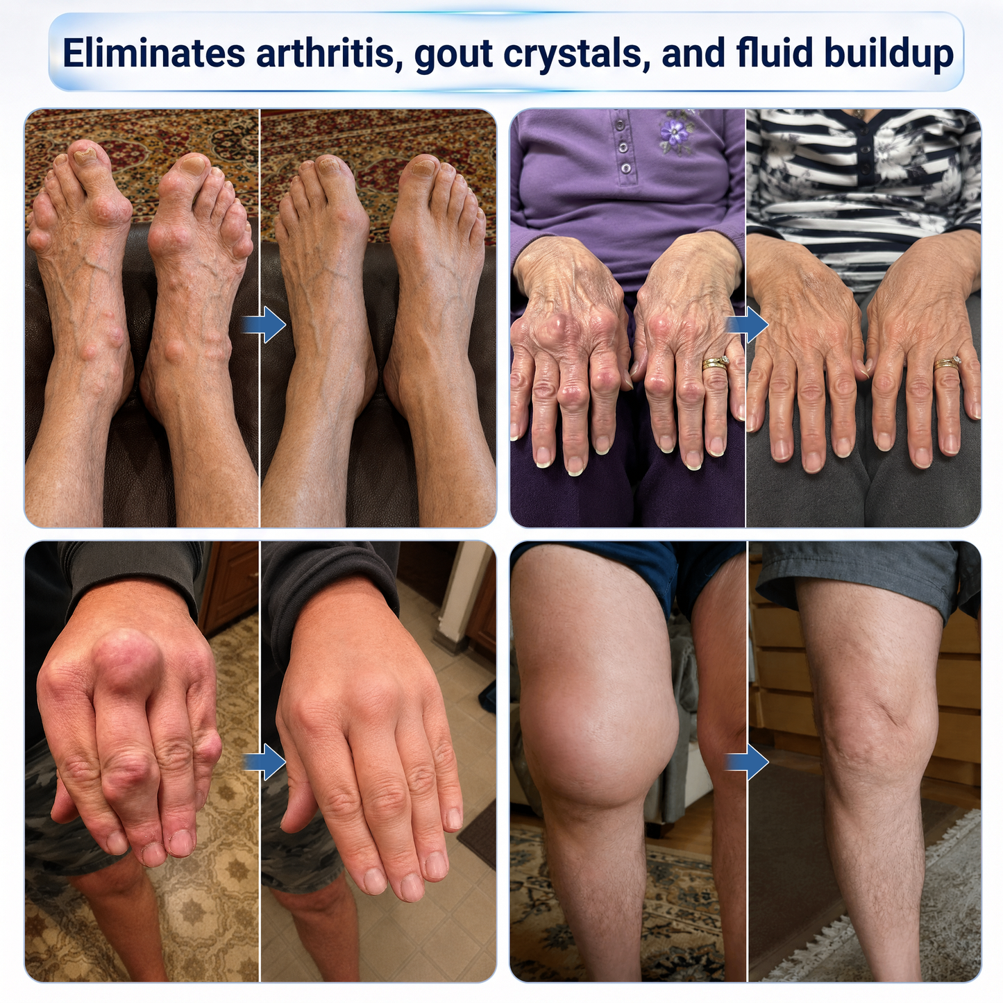 IFMAGIC® Microneedle Joint Relief Roll-On | Micro-Tip Delivery for Knees, Hands, Back & Shoulders