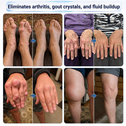 IFMAGIC® Microneedle Joint Relief Roll-On | Micro-Tip Delivery for Knees, Hands, Back & Shoulders